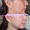 미소메디칼 | 대구 수성구피부관리 미소스킨앤바디 윤곽관리 메디컬 에스테틱 후기