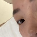 루아쏘 이미지