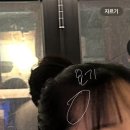 민성형외과의원 | [공지] [내돈내산]•모더함의원 모발 이식 1700모 후기-1편