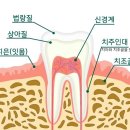 니즈연합치과 네이버블로그