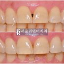 서울리멤버치과의원 이미지
