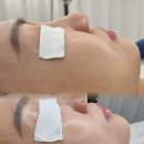 파주 탄력관리~! 탄력과 미백을 동시에 ! 엔젤스뷰티 방문후기
