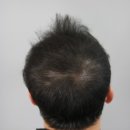 스칼프디자인센터 이미지