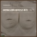 구리피부관리 어반에스테틱에서 윤곽관리 받은 리얼후기