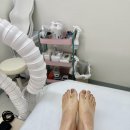 문제성발관리센터발을 | 수원발각질관리 수원문제성발관리 온리풋 발각질 제거 후기ㅣ비포 애프터