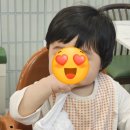 에스앤유피부과의원 | 마포공덕 에스앤유피부과 7개월 아기 피지선모반 진료후기