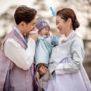 골드제이의원 | 선릉역 골드제이의원 셀프 이마필러 후기 feat.붓기, 부작용, 통증, 유지기간