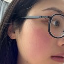 제네시스카페 | 듀얼토닝제네시스 받기 전에 반드시 알아야 할 것 모르면 돈 날림