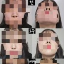 서울퀸성형외과의원 이미지