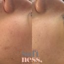 소프니스 이미지