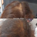 미담케어 이미지