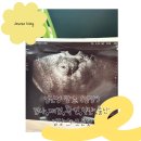 임신성당뇨 원인 검사 재검 확진 식단 출산 찐 겪은 후기