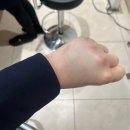 웨딩다이어트, 결혼 앞둔 예비신부의 지방흡입 관리 후기, 팁