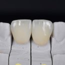 크리스탈치과기공소 이미지