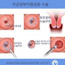 경부한의원 | 자궁경부이형성증 재발 및 치료, 완치가 가능할까