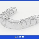 가락시장역 8번출구 | [문정동 가락시장역 치과] 이가 짧아지고 닳는 느낌? '교합 붕괴' 신호일 수 있어요