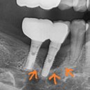 뿌리깊은 이정근치과의원 이미지
