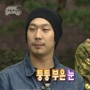 강남ㅇㅇㅅ안과 투데이라섹 후기
