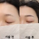 북면309 | [창원북면감계] 자연눈썹 잘하는 곳 '시선'