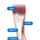 아킬레스건 통증 원인 및 과 : 파열 염증(아킬레스건염) 이미지