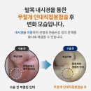 걷기 힘든 통증까지 확실한 해결로 이끄는 서울족부병원 방배역정형외과로 이미지