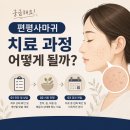 편평사마귀, 치료 과정 그리고 유지 기간 궁금하시죠?
