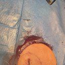 오름메디 이미지