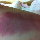 미소생한의원 이미지