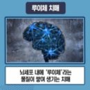 치매의 종류