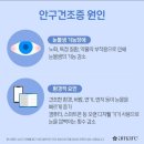 아마레 이미지
