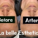 라 벨르 에스테틱 이미지