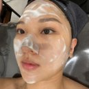 양덕동118 | <양덕동 로벅> 윤곽리프팅 맛집 턱선 살아났어요^^