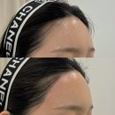 구미 문성 블랑유니 헤어라인 왁싱 후기｜깔끔한 이마라인 완성