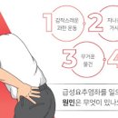 급성 요추염좌, 허리염좌 및 신경차단술 (허리 삐끗, 부작용) 이미지