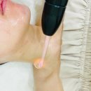 5764 | 당진피부관리 여드름 트러블에 좋은 플라즈마 후기 *뷰티스타*