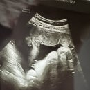 서정동물병원 | ✏️임신기록 4탄 | 🍼임신 30~35주 • 임신후기 • 만삭사진 • 백일해 접종 • 경부 길이 입원⭐️