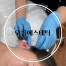 광교피부관리 이혈테라피 귀건강관리 연예인관리 계절테라피 이어테라피 후기[오름에스테틱]