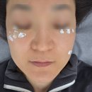 청라잡티관리 인천잡티관리 디어브로우 솔직후기