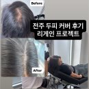 리게인프로젝트 전주점 전주탈모 전주두피문신 전주두피커버 추천 후기