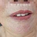 고봉로26길 | [임상후기]30년 된 구안와사 후유증, 2회 만에 편안해졌어요!