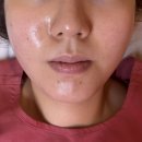 김한의원 | 평촌다이어트한의원 이중턱 및 복부 다이어트 후기