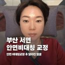 얼굴 | 부산안면비대칭 교정 후 달라진 얼굴 후기