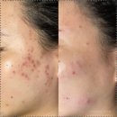 퓨어르떼(PURERTE) 네이버블로그