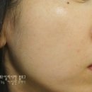 헬렌케이 이미지