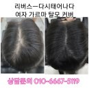 탈모응급실 리버스-다시태어나다 이미지