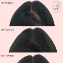 디어니즈 이미지