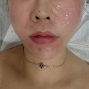 삼주메타 | 이번엔 서초동 내과 MCT 메타셀 줄기세포 주사 2회차 후기!!