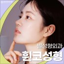 루나이비인후과의원 | 휜코교정보험 적용 방법과 루나코 성형의 장점