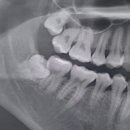 퍼스트민치과의원 이미지