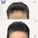 (주)마이크로청담 이미지